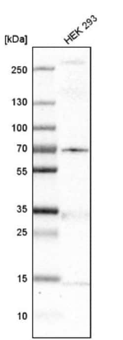MKS1 Antibody, Novus Biologicals:Antibodies:Primary Antibodies